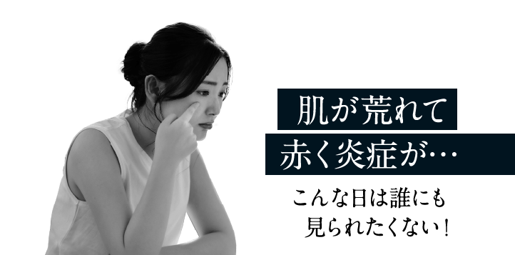 肌が荒れて赤く炎症が…こんな日は誰にも見られたくない！